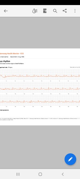 Ongoing centre chest pains, breathleness, upper back pain, been to A&E 3 times in 1 month 