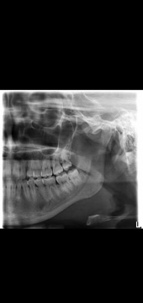 Dental advice