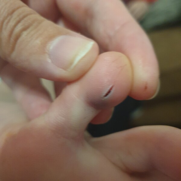 Do we think this will heal by itself?