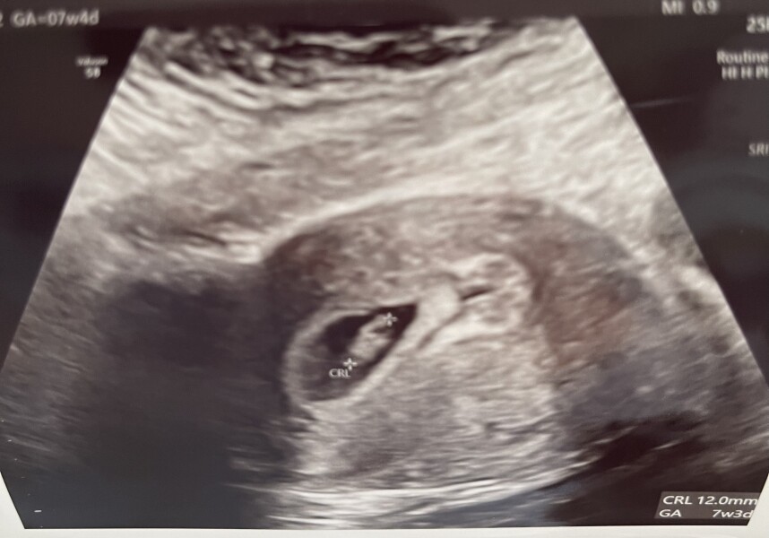 IVFers Due Mar & Apr 2023