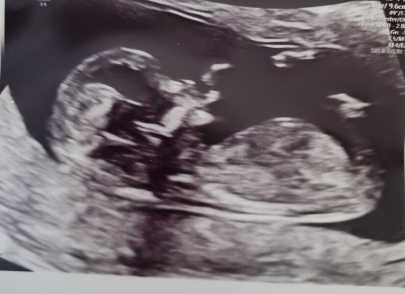 Boy or girl guesses