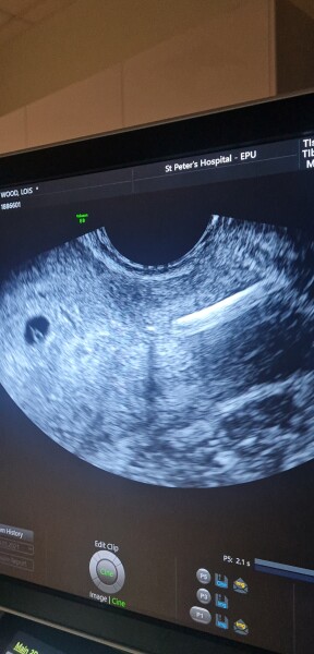 Due March 2023 ✨👶☀️🌈