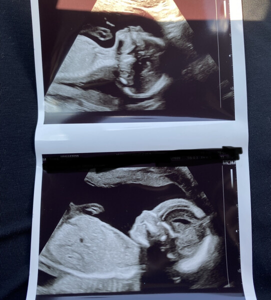 Due December 2022 (thread 4)