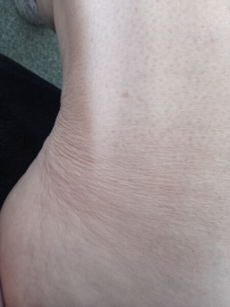 Crepey skin on legs - how to treat?