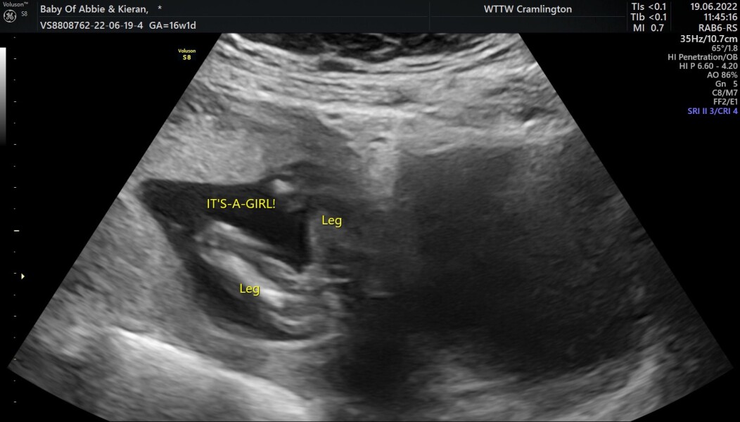 Is this definitely a girl?