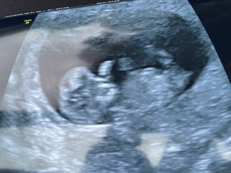 Due Feb/Mar after MC 🌈 🙈