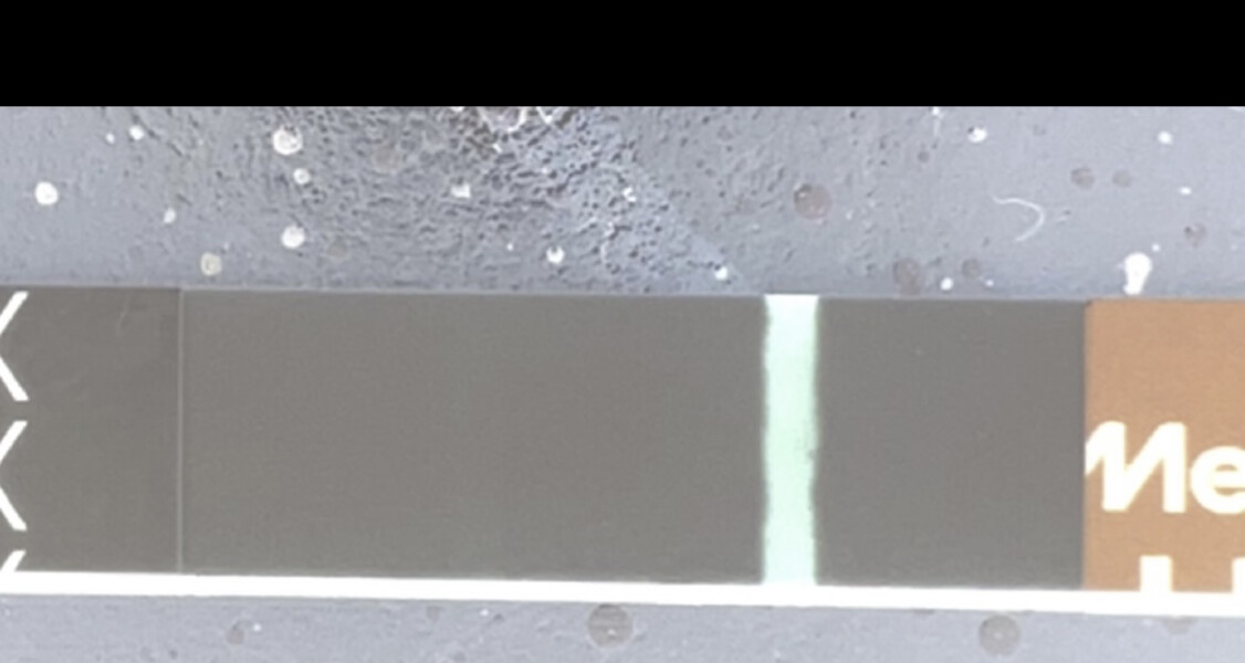 Indent or faint positive?