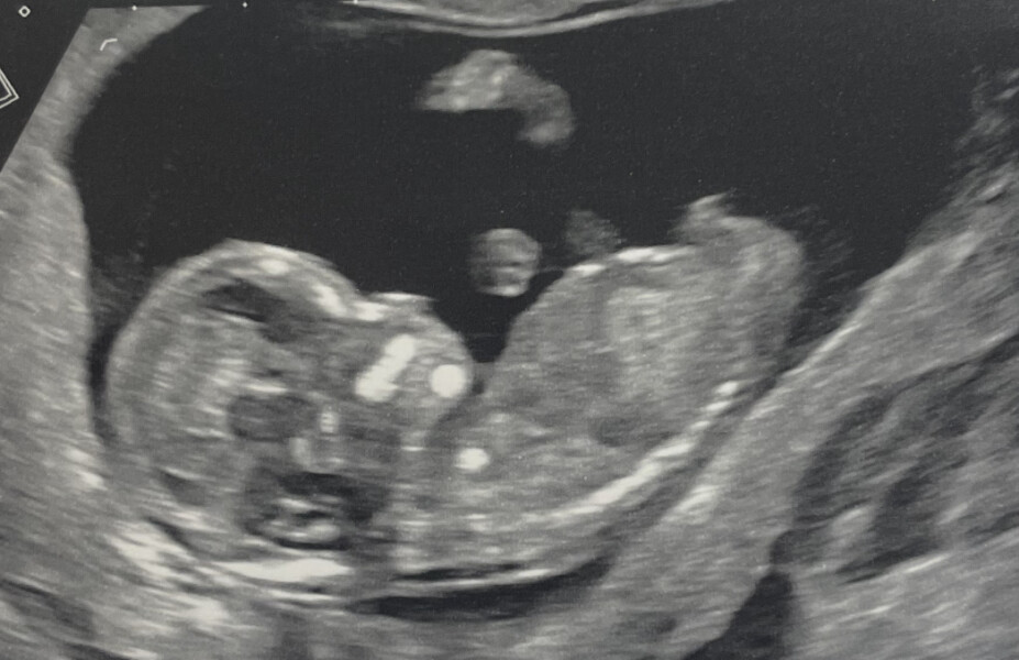 Guess my baby’s gender! 