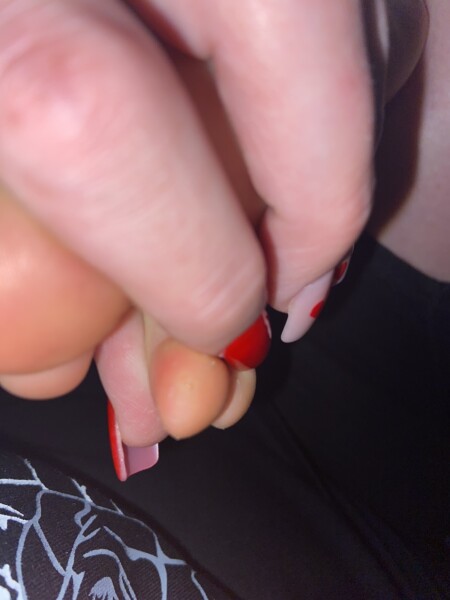 What's this on my kids foot?