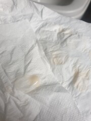 Discharge 6+4  (pictures attached)