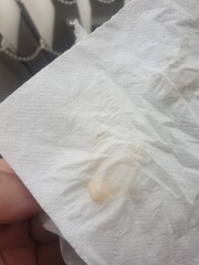 Discharge 6+4  (pictures attached)