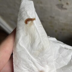 Gross pics alert