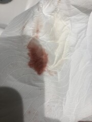 Am I having a chemical pregnancy? TMI but pic included 