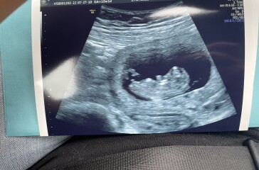 Gender guess - 10 week scan