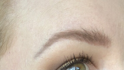 Eyebrow improvement 