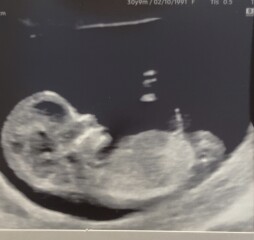 Girl or boy 