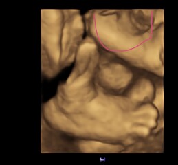 Does this look like a boy? 