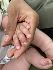 Sick with worry- baby's finger