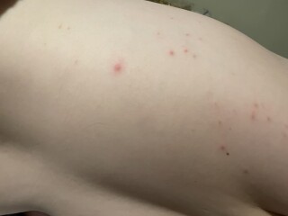What are these spots?