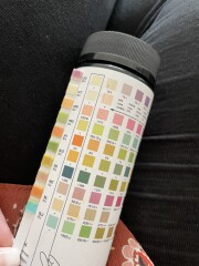 Any nurses/ GPs? Urine dipstick reading...