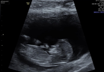 So, the sonographer said "he" 