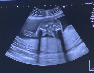 20 week potty shot confusion