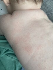 Very dry skin?