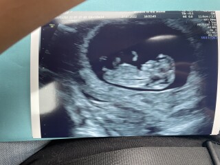 Gender guess - 10 week scan