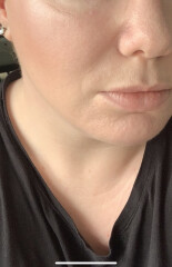 At my wits end with skincare that doesn’t work