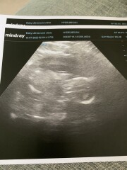 Boy or Girl?! What do you all think? 