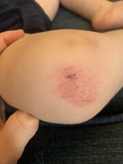 To be fed up of nursery sending my kid home filthy?