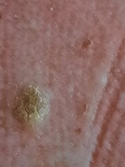 What is this growth (photos)