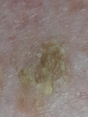 What is this growth (photos)