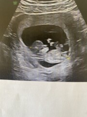 Any guesses? 