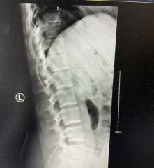 X-rays 