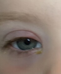 DD’s eye - help please! 