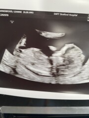 Hey can any guess girl or boy :)