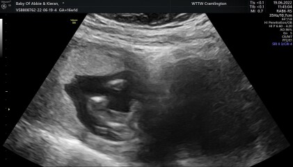 Is this definitely a girl?