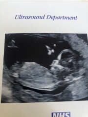 Nub theory, boy or girl?