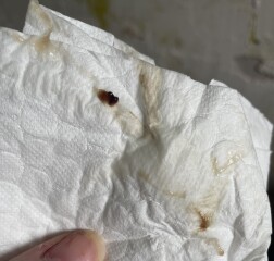 Gross pics alert
