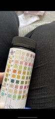 Any nurses/ GPs? Urine dipstick reading...