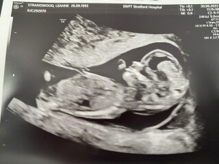 Hey can any guess girl or boy :)