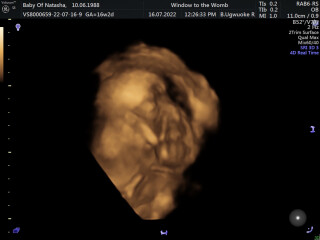 Due December 2022 (thread 4)