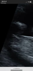 So, the sonographer said "he" 
