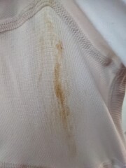 Is this discharge colour normal? (Photo included)
