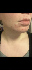 At my wits end with skincare that doesn’t work