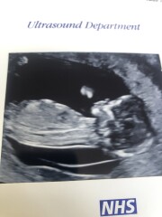 Nub theory, boy or girl?