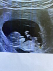 Any guesses? 