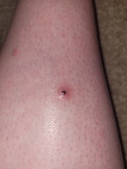 What is this on my leg? 