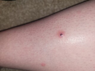 What is this on my leg? 
